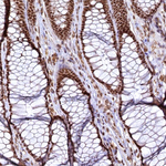 RSRC2 Antibody in Immunohistochemistry (Paraffin) (IHC (P))