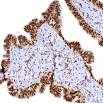 RSRC2 Antibody in Immunohistochemistry (Paraffin) (IHC (P))
