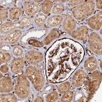 MYO9A Antibody in Immunohistochemistry (Paraffin) (IHC (P))