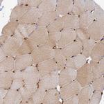 MYO9A Antibody in Immunohistochemistry (Paraffin) (IHC (P))