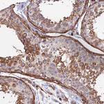 MYO9A Antibody in Immunohistochemistry (Paraffin) (IHC (P))