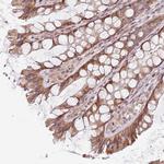 CHURC1 Antibody in Immunohistochemistry (Paraffin) (IHC (P))