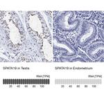SPATA19 Polyclonal Antibody