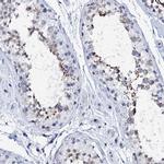 SPATA19 Antibody in Immunohistochemistry (IHC)