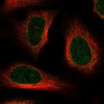 Aladin Polyclonal Antibody