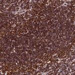 Aladin Antibody in Immunohistochemistry (Paraffin) (IHC (P))