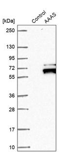 Aladin Antibody in Western Blot (WB)