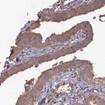 Layilin Antibody in Immunohistochemistry (IHC)
