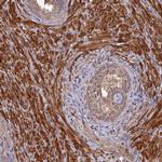 Layilin Antibody in Immunohistochemistry (IHC)