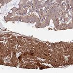 Layilin Antibody in Immunohistochemistry (IHC)