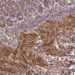 Layilin Antibody in Immunohistochemistry (IHC)