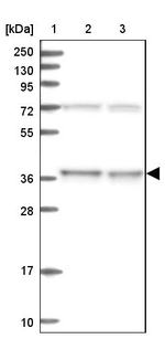 C11orf54 Antibody in Western Blot (WB)
