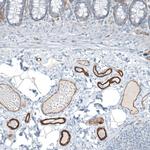 Agrin Antibody in Immunohistochemistry (Paraffin) (IHC (P))