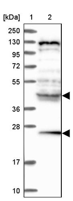 HYI Antibody in Western Blot (WB)
