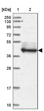 LRRC2 Antibody in Western Blot (WB)