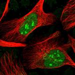 H1FX Polyclonal Antibody