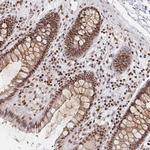 H1FX Antibody in Immunohistochemistry (Paraffin) (IHC (P))