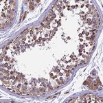 RNF17 Antibody in Immunohistochemistry (Paraffin) (IHC (P))
