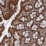 C13orf30 Polyclonal Antibody