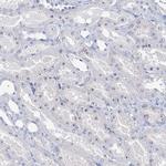 NOP2 Antibody in Immunohistochemistry (Paraffin) (IHC (P))