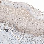C11orf84 Antibody in Immunohistochemistry (Paraffin) (IHC (P))