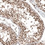 C11orf84 Antibody in Immunohistochemistry (Paraffin) (IHC (P))