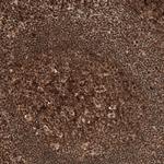 C11orf84 Polyclonal Antibody