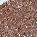 HOMER2 Polyclonal Antibody