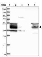 HOMER2 Antibody in Western Blot (WB)