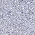 SCEL Antibody in Immunohistochemistry (IHC)