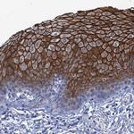 SCEL Antibody in Immunohistochemistry (IHC)