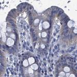 SCEL Antibody in Immunohistochemistry (IHC)