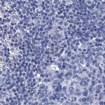 SCEL Antibody in Immunohistochemistry (IHC)
