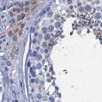 SCEL Antibody in Immunohistochemistry (IHC)