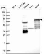 SCEL Antibody in Western Blot (WB)