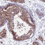 MAST2 Polyclonal Antibody