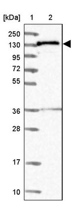NAA16 Antibody in Western Blot (WB)