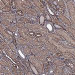 USPL1 Polyclonal Antibody