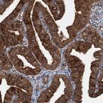 AAGAB Antibody in Immunohistochemistry (Paraffin) (IHC (P))