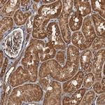 AAGAB Antibody in Immunohistochemistry (Paraffin) (IHC (P))