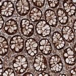 AAGAB Antibody in Immunohistochemistry (Paraffin) (IHC (P))