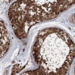 AAGAB Antibody in Immunohistochemistry (Paraffin) (IHC (P))
