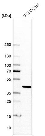 AAGAB Antibody in Western Blot (WB)