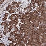 FAM111A Antibody in Immunohistochemistry (Paraffin) (IHC (P))