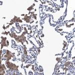 FAM214A Antibody in Immunohistochemistry (Paraffin) (IHC (P))