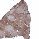 FAM214A Antibody in Immunohistochemistry (Paraffin) (IHC (P))