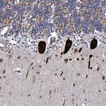 FAM214A Antibody in Immunohistochemistry (IHC)