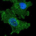 FAM222A Polyclonal Antibody