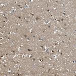 FAM222A Antibody in Immunohistochemistry (Paraffin) (IHC (P))