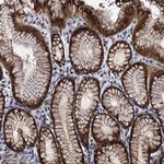 FAM222A Antibody in Immunohistochemistry (Paraffin) (IHC (P))